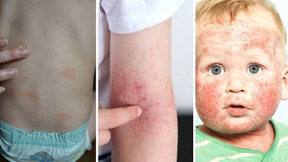 צילום מתוך דף הפייסבוק מרכז שניידר לרפואת ילדים בישראל